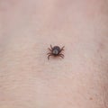 contagious insect a tick crawling on human skin Royalty Free Stock Photo