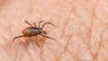 Closeup of female deer tick parasite on human skin background. Ixodes ricinus