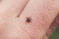 dangerous insect mite crawls on the skin of the human hand Royalty Free Stock Photo