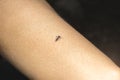 Dangerous Zica virus mosquito sucking bloode on human skin cause sick