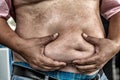 The Dangers of Belly Fat., Obese Man in Jeans Squeeze the Belly