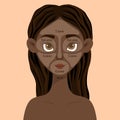 Dark-skinned girl with a scheme of skin zones on her face. Cartoon style. Vector illustration