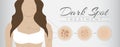 Dark Spot Treatment Illustration Design with Woman and Melasma Skin Pigmentation Royalty Free Stock Photo