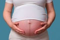 Dark stripe on the belly of a pregnant woman, studio shot on a blue background