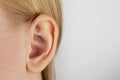 Darwin`s tubercle on the ear. The girl at the reception at the plastic surgeon, shows the auricle Royalty Free Stock Photo