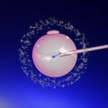 3DCG illustration image of human micro insemination.