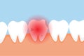 Dead tooth hurting and giving a red pain signal concept. A bad tooth with cavities and a red danger signal. Dental infographic
