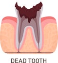 Dead Tooth Problem