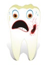 Decayed Molar Tooth Royalty Free Stock Photo