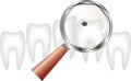 Decayed tooth under magnifying glass , dentistry