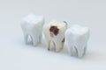 The decayed tooth beside with the white tooth, 3d rendering