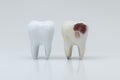 The decayed tooth beside with the white tooth, 3d rendering Royalty Free Stock Photo