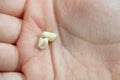 Deciduous primary baby temporary teeth, the first set of teeth in the growth and development of humans, They are usually lost and