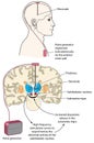 Deep brain stimulation