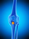 The deep infrapatellar bursa Royalty Free Stock Photo