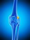 The deep infrapatellar bursa Royalty Free Stock Photo