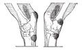 Defects of the Hock or Gambrel of a Horse, vintage engraving