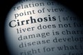 Definition of cirrhosis Royalty Free Stock Photo