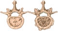 Degenerative changes vertebra