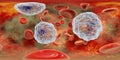 360-degree spherical panorama of blood with eosinophilia