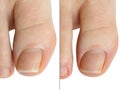 Deleting cuticle nail beauty salon