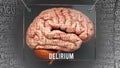 Delirium in human brain