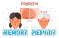 Dementia or alzheimer`s disease concept vector illustration diagram with young and old woman. Royalty Free Stock Photo