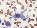 Dendritic cell in bone marrow.