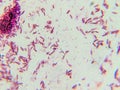 Dense Clumps of Rod-Shaped Bacteria (Bacilli) Under a Microscop Royalty Free Stock Photo