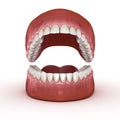 Dental anatomy - Opened Dentures. Medically accurate dental 3D illustration Royalty Free Stock Photo