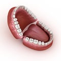 Dental anatomy - Opened Dentures. Medically accurate dental 3D illustration Royalty Free Stock Photo