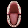 Dental anatomy - Opened Dentures. Medically accurate dental 3D illustration Royalty Free Stock Photo