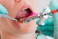 Dental anesthesia