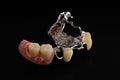 Dental appliances and dental prostheses.