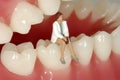Dental Appointment Royalty Free Stock Photo