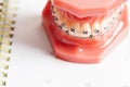 Dental appointment reminder in calendar, healthy teeth, dental health care