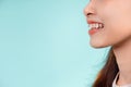 Dental Beautiful smiling of young asian woman with retainer braces glad emotion Royalty Free Stock Photo