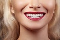 Dental Beauty. Beautiful Macro of perfect White Teeth. Sexy Fashion Lip Red Makeup. Whitening Tooth, Wellness Treatment Royalty Free Stock Photo
