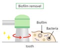 dental biofilms removel illustration. dental health and oral care concept