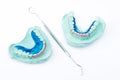 Dental brace Royalty Free Stock Photo