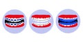 Dental braces, essix aligner or orthodontic Hawley retainer on teeth.Poster in pop art style.Oral care and daily routine.