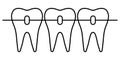 Dental braces icon, orthodontic teeth alignment for a beautiful smile