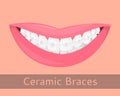 Dental braces, smiling lips in cartoon style isolated.