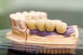 Dental bridge made of porcelain on casting Royalty Free Stock Photo