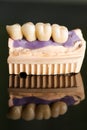 Dental bridge made of porcelain on casting Royalty Free Stock Photo