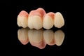 Dental bridge of 4 teeth on artificial gums. Close-up photo of ceramic teeth crown isolated on black glass background