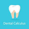 Dental calculus. Bad oral hygiene and damaged