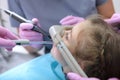 Dental care for children. Superficial sedation. Treatment of children`s teeth with nitrous oxide. Photos in the interior of the