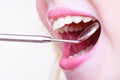 Woman teeth and dentist mouth mirror Royalty Free Stock Photo