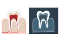 Dental care flat decorative icons set with stomatologist tools Stomatologist.